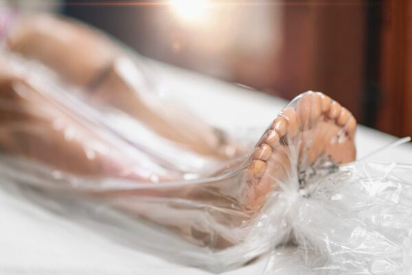 Vacuum Slimming Anti Cellulite Therapy