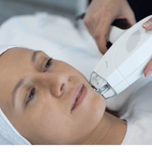 Woman receiving RF fractional resurfacing treatment with the Howganics V10 - V-FR handpiece for skin rejuvenation